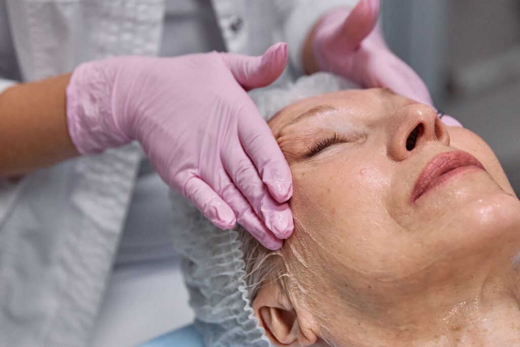Woman getting microneedled service