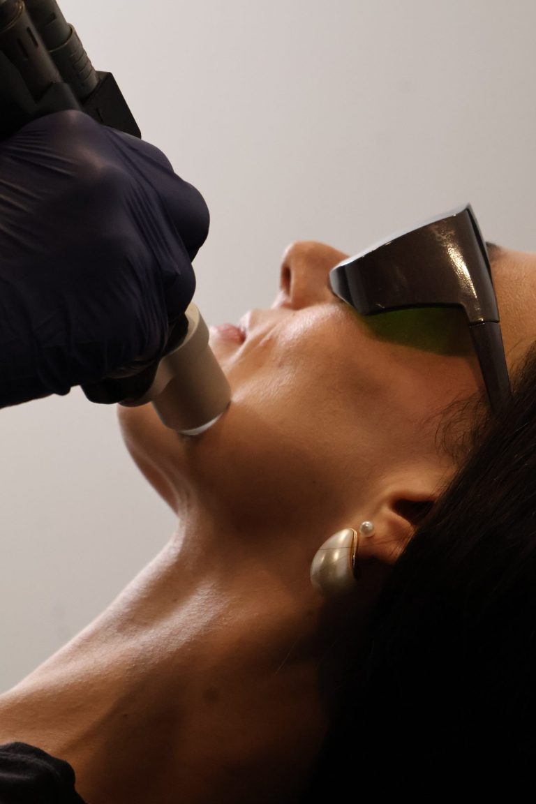 the-fix-laser-facial-closeup-06.webp-scaled.jpg